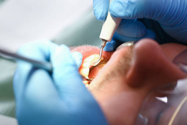 Best Urgent Dental Care for Toothaches in Gwinn, MI